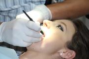 Az all-on-4 fogászati implantátumok jelentősége
